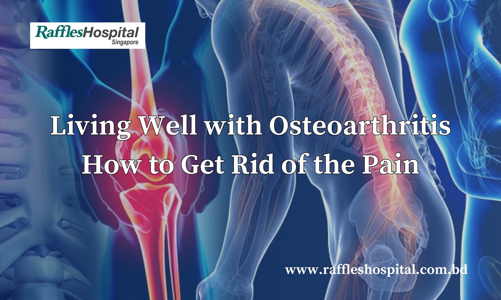 Living Well with Osteoarthritis